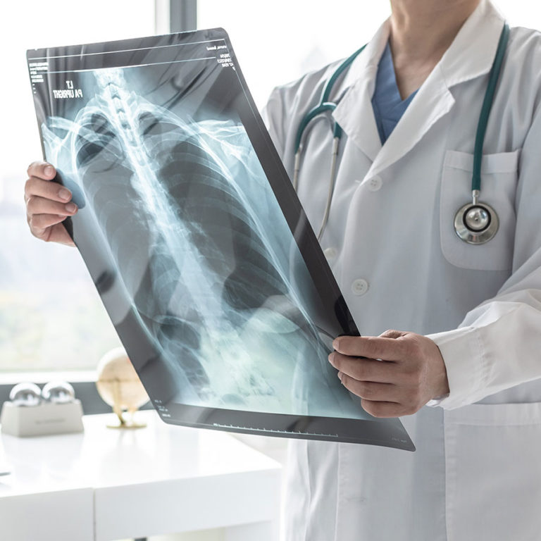Understanding, preventing and treating TB